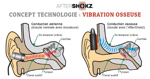 aeropex-conduction-osseuse-ecouteur-trakks-specialiste-running